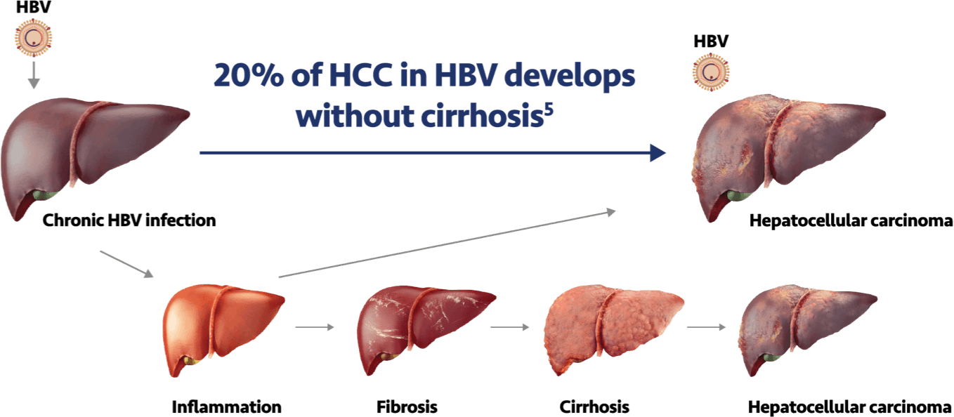 Stages of liver progression