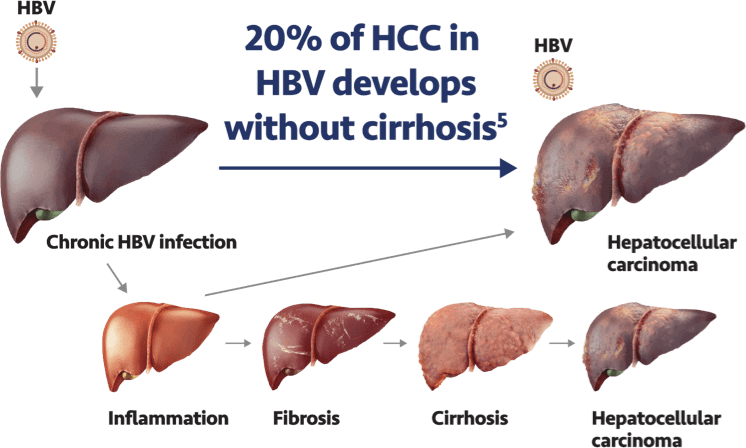 Stages of liver progression